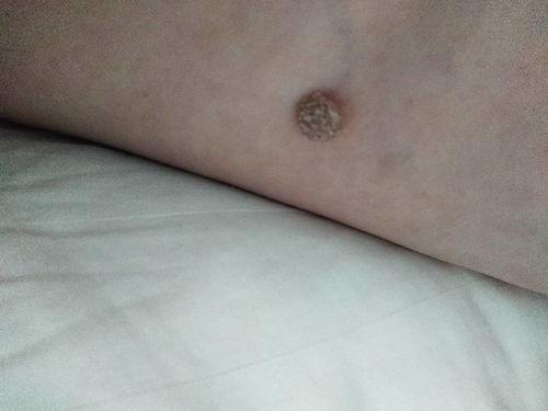 痣刺瓜怎么吃,解锁美味新体验